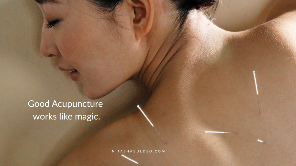 Best Acupuncture Bedford