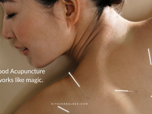 Finding the Best Acupuncture in Bedford